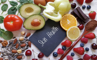 Skin Issues? These 5 Foods for Healthy Skin Can Help